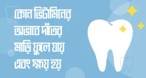 Read more about the article কোন ভিটামিনের অভাবে দাঁতের মাড়ি ফুলে যায় এবং ক্ষয় হয় গুরুত্বপূর্ণ তথ্য
